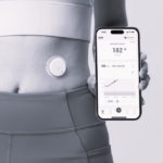 TLS Glucose Monitoring 2 BW